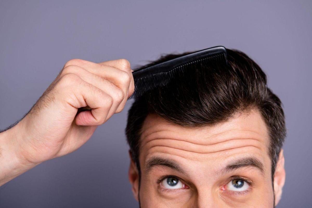Is Hair Transplantation Performed For The Hair?